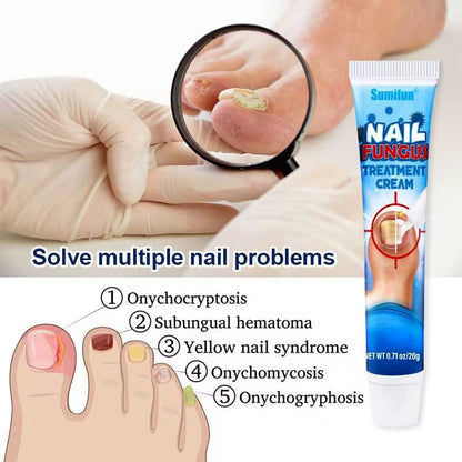 Sumifun - Nail Fungus Treatment